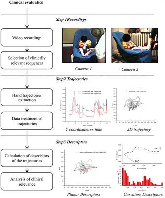 Developmental Trajectories of <mark class="highlighted">Hand Movements</mark> in Typical Infants and Those at Risk of Developmental Disorders: An Observational Study of Kinematics during the First Year of Life